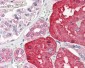 ACY1 / Aminoacylase 1 Antibody
